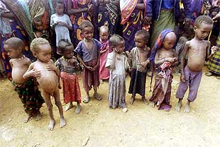 niños desnutridos, africa, desnutrición, bendecir, alguien